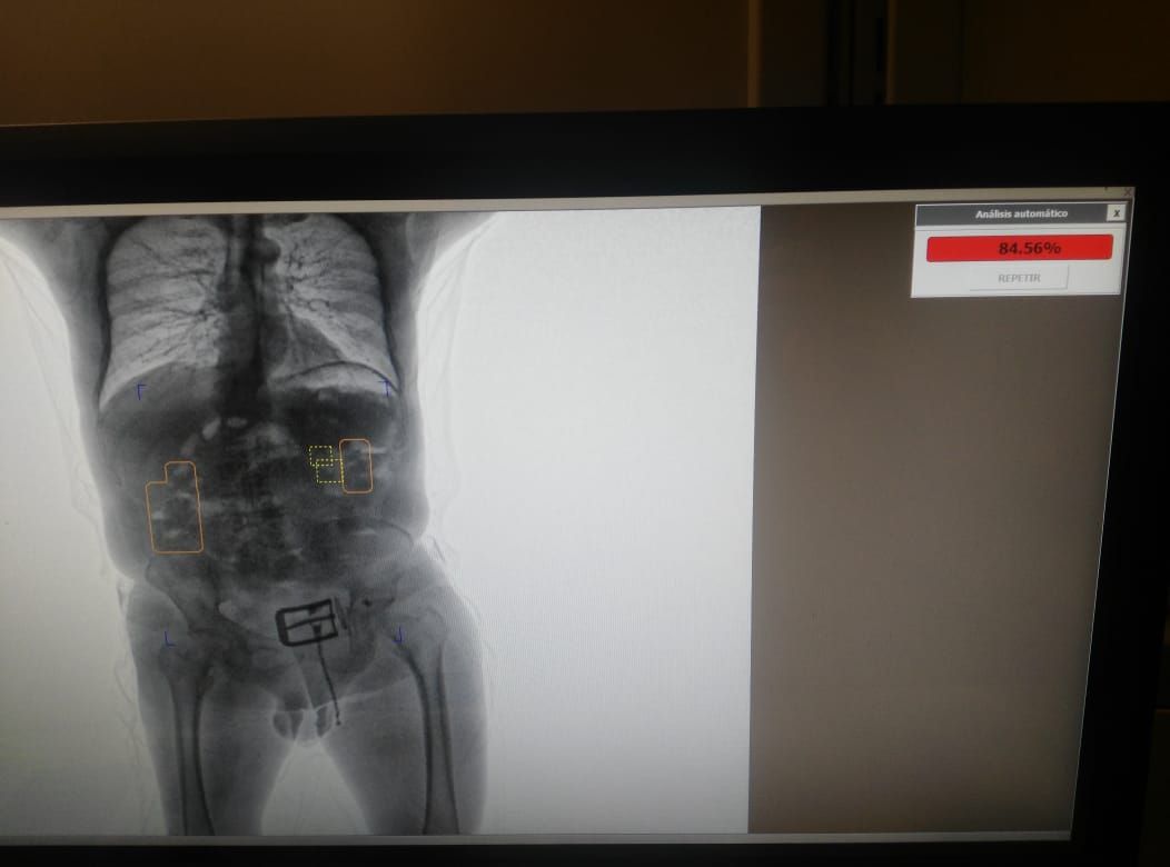 Capturado-un-pasajero-con-más-de-un-kilo-de-cocaína-en-el-abdomen