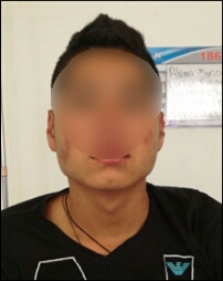 Capturan-a-dos-personas-cuando-llevaban-1.250-gramos-de-heroína-en-su-abdomen